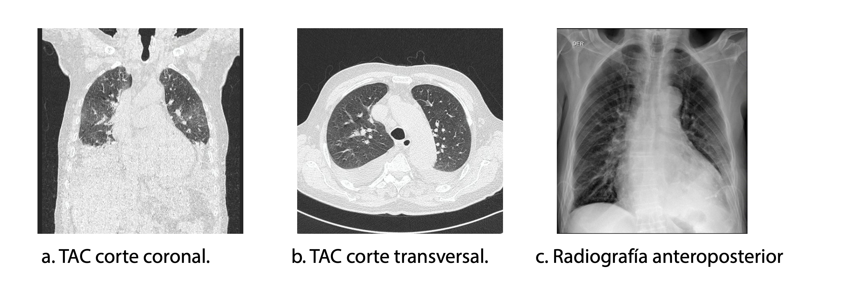 Imágenes radiológicas del tórax