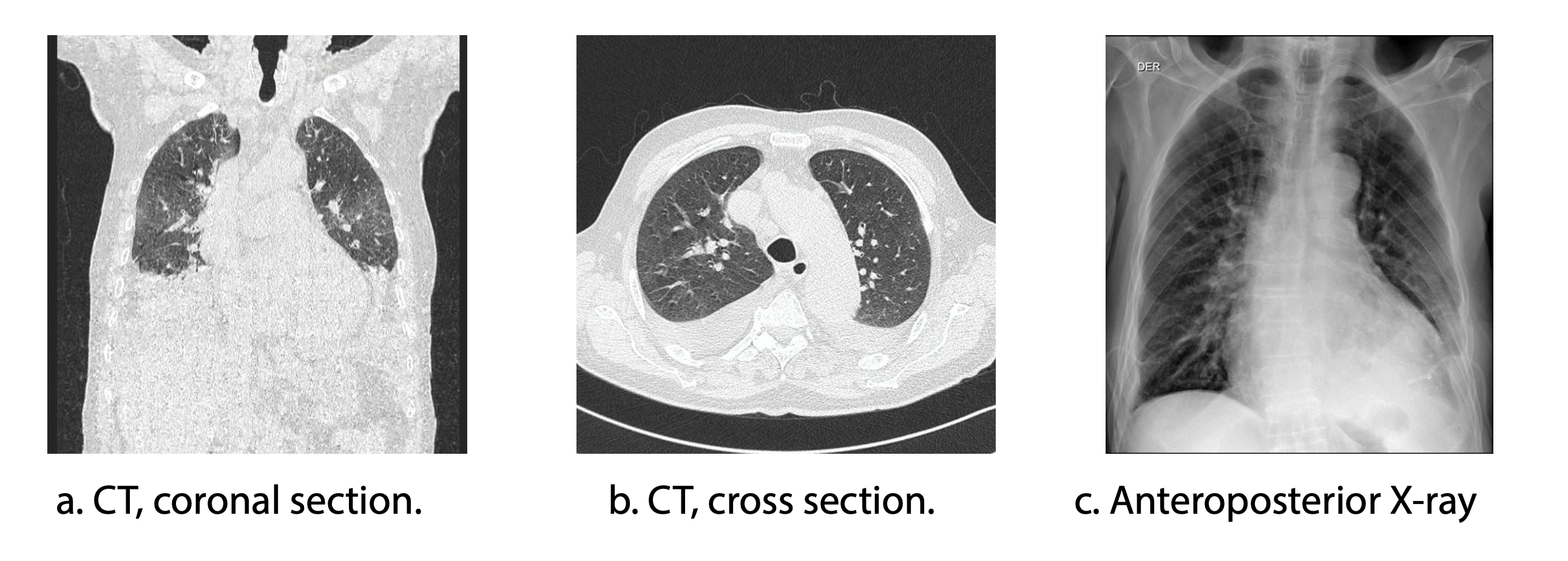 Imágenes radiológicas del tórax